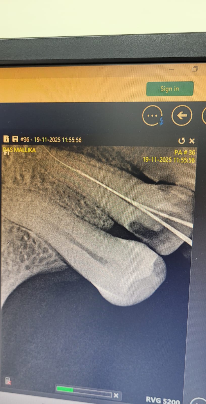 Dental Care