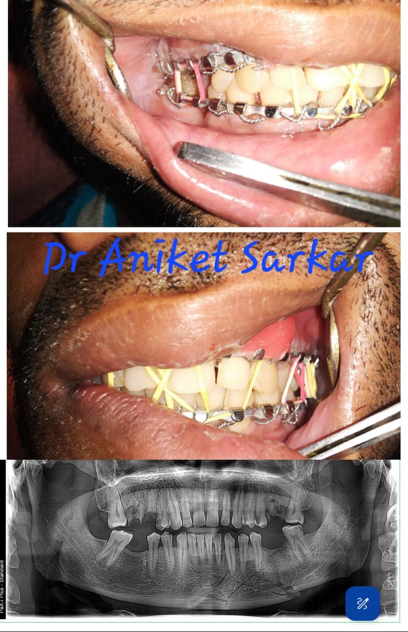Smile Transformations