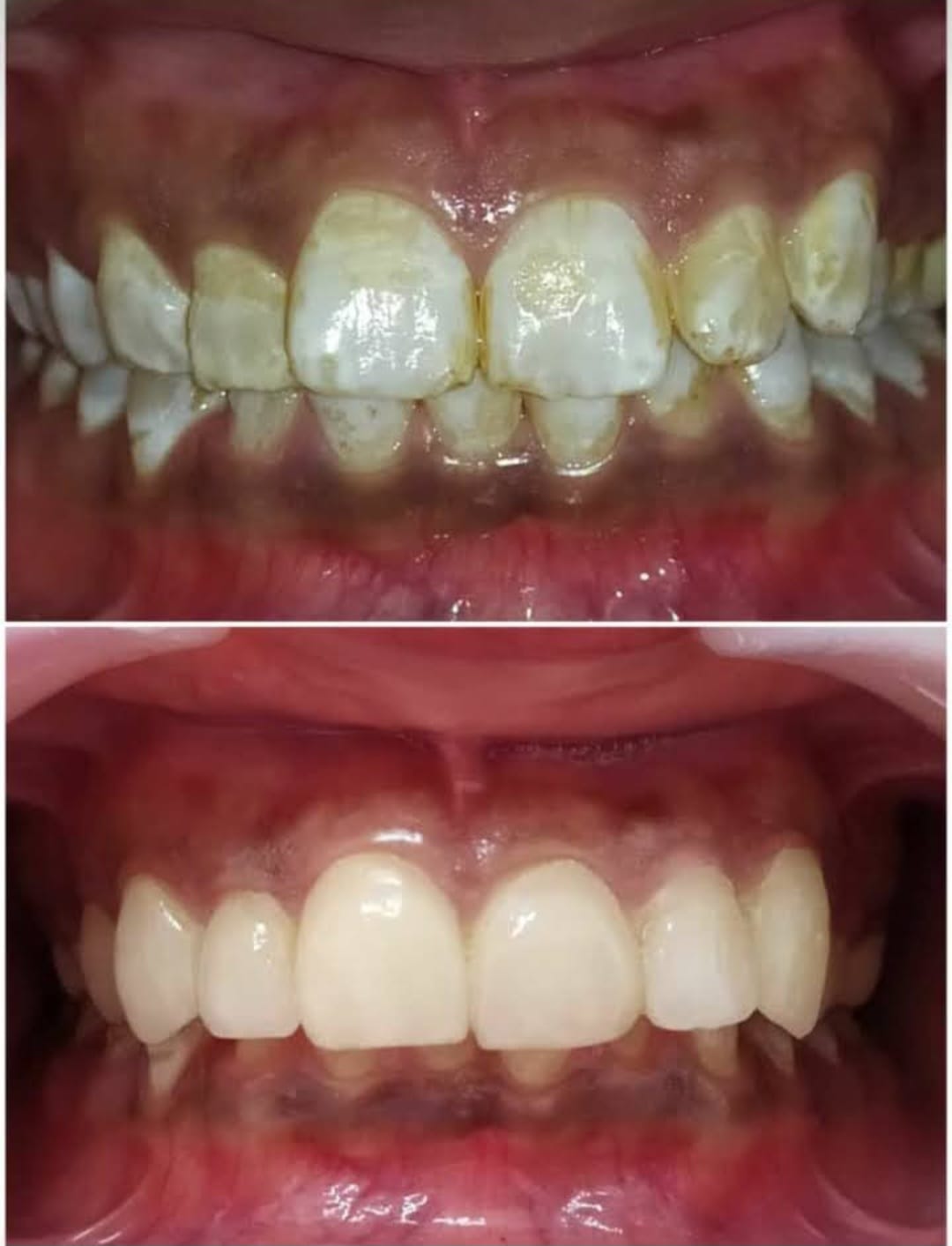 Happy Patients