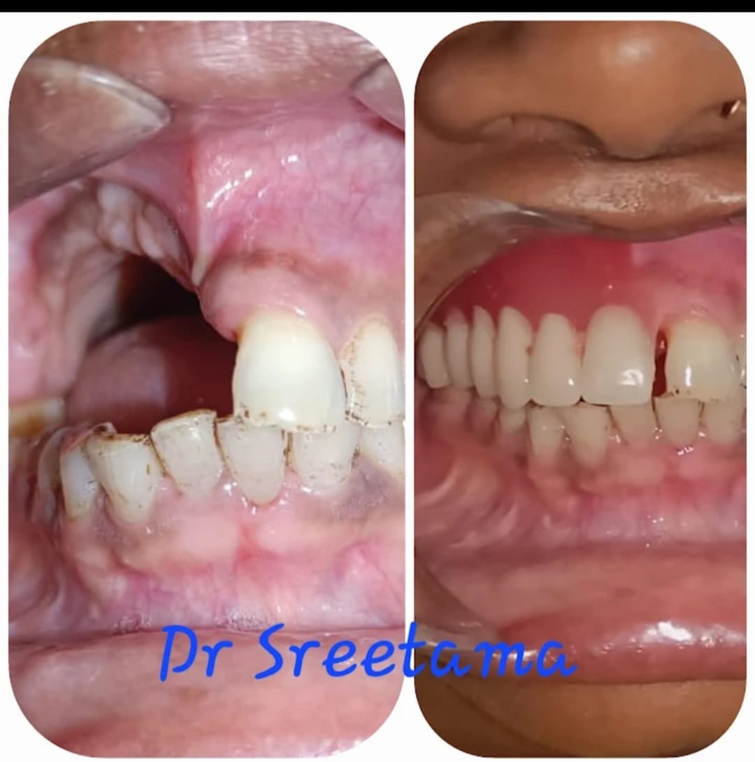 Child Dentistry