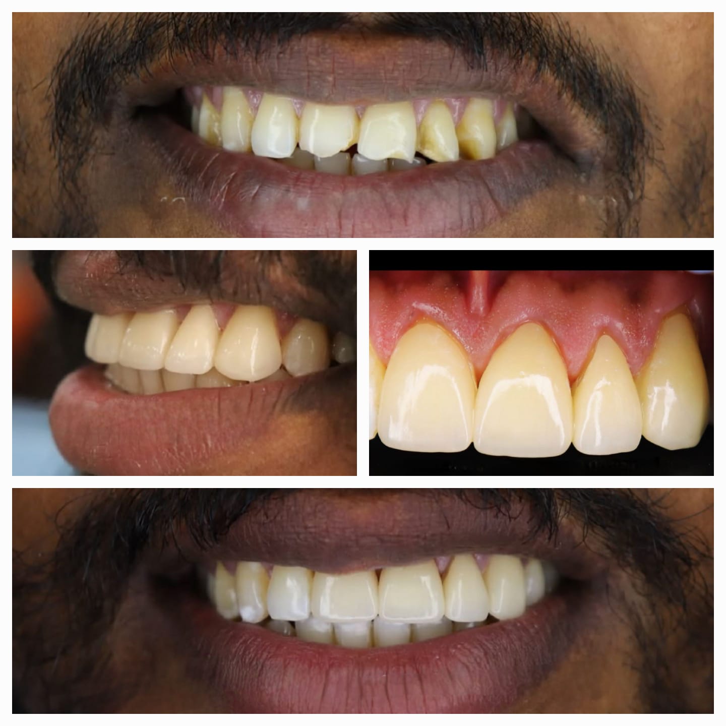 Oral Surgery